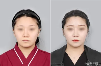 Before & After