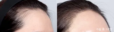 Before & After