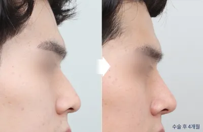Before & After
