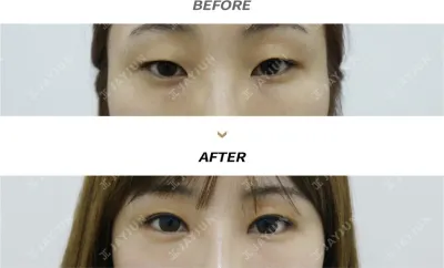 Before & After