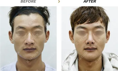 Before & After