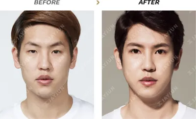 Before & After