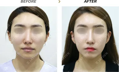 Before & After