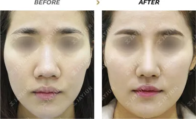 Before & After