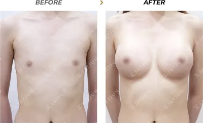 Before & After