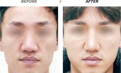 Before & After