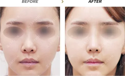 Before & After