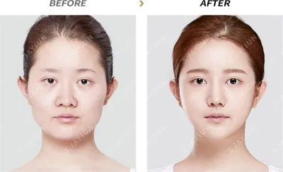 Before & After