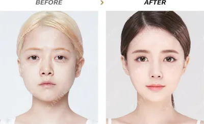 Before & After