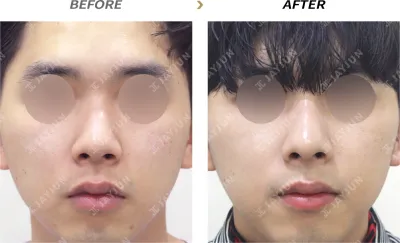 Before & After