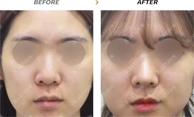 Before & After