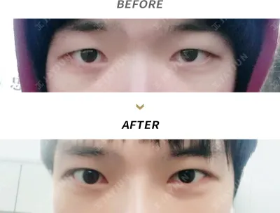 Before & After