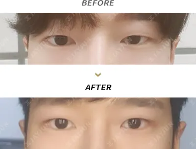 Before & After