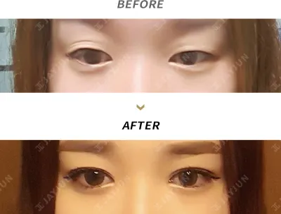 Before & After