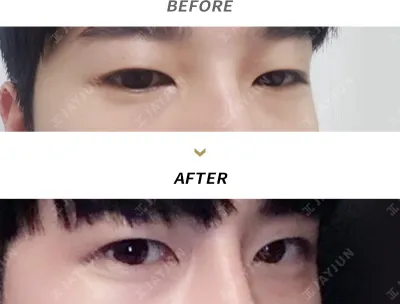 Before & After