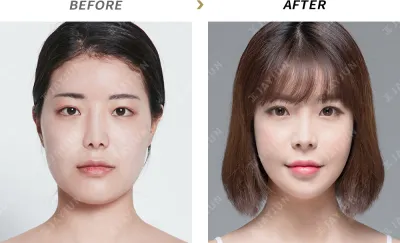Before & After