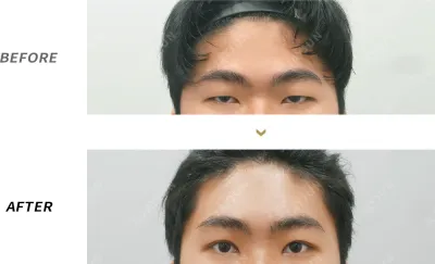 Before & After