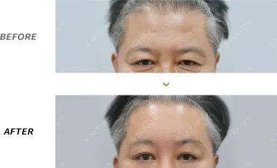 Before & After