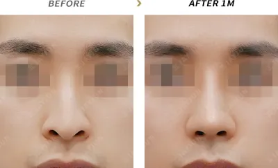 Before & After