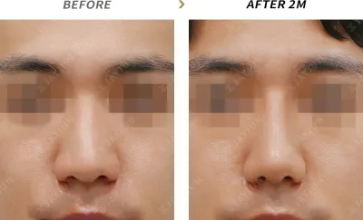 Before & After