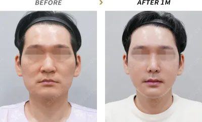 Before & After