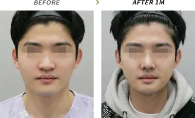 Before & After