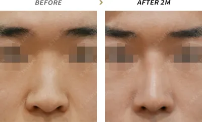 Before & After