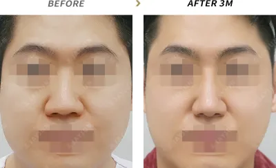 Before & After