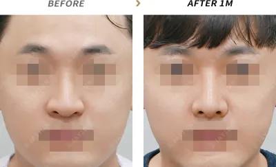Before & After