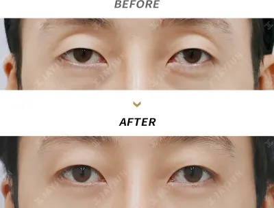 Before & After