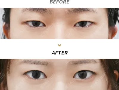 Before & After