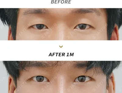Before & After
