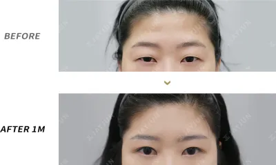 Before & After