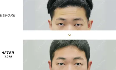Before & After