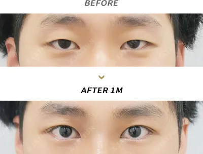 Before & After