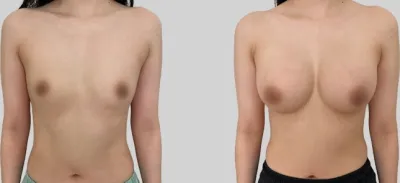 Before & After