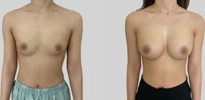 Before & After
