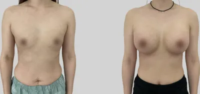Before & After