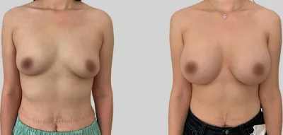 Before & After