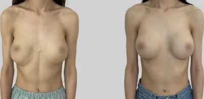 Before & After