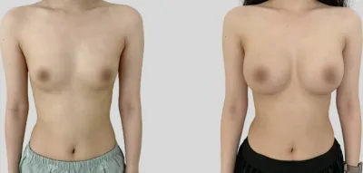 Before & After