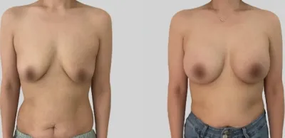 Before & After