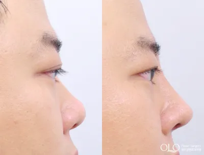 Before & After