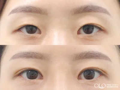 Before & After