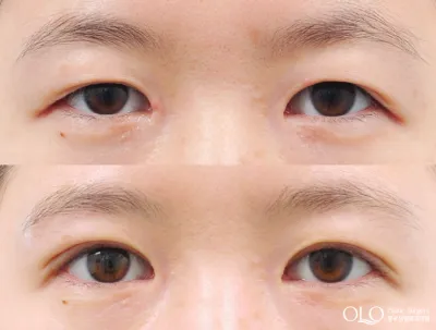 Before & After