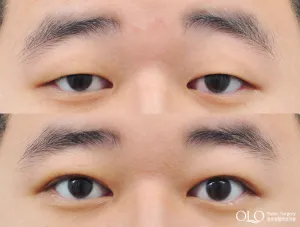 Before