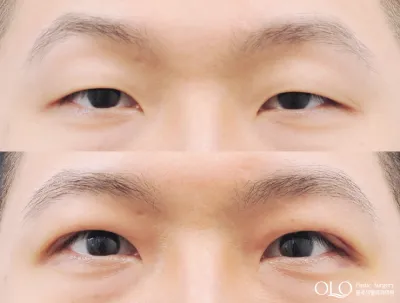 Before & After