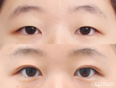Before & After