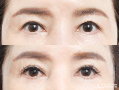Before & After