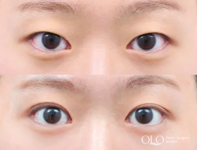Before & After